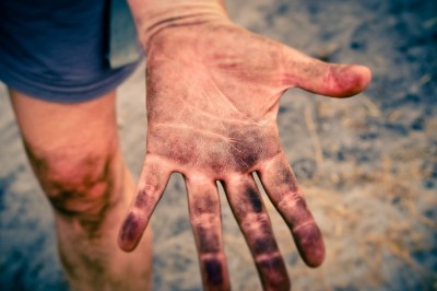 Tips On How To Deal With Greasy Hands