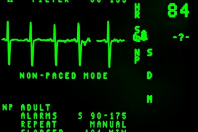 The Meaning of Abnormal EKG Results